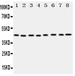 WB - Anti-PGK1 Antibody ABO11352
